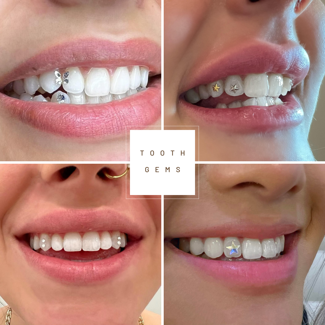 Tooth Gems Xccessorize.me